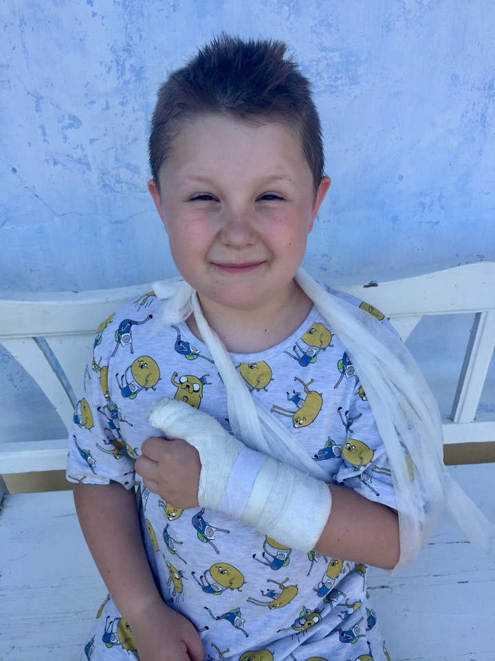 Prázdniny - Samuel Kennedy natáčal so sadrou na ruke